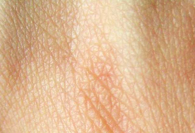 piel órgano más grande del cuerpo humano